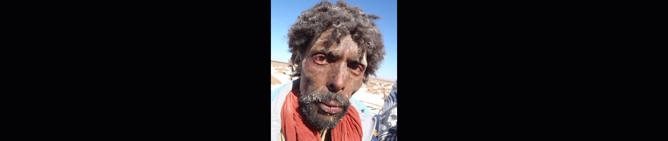 Black Gold, Dominique colladant Make-up SFX