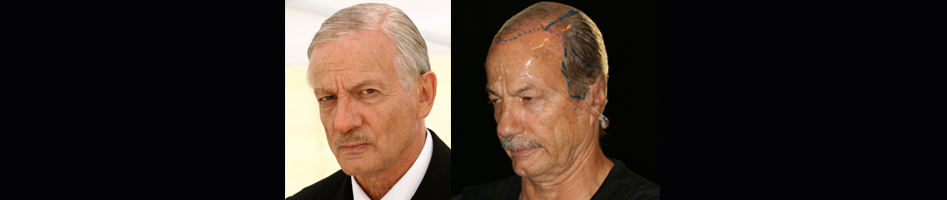 Patrick Chesnais, Serge Moati, De gaulle L'autre Guerre - Dominique colladant Make-up SFX